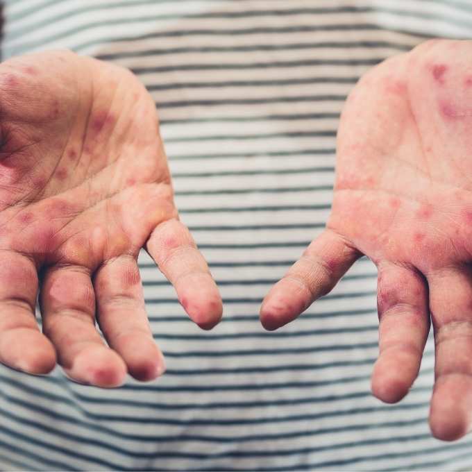 Virginia Crime Scene & Trauma Cleanup Services